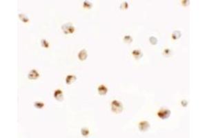 Immunocytochemistry of SDHD in EL4 cells with SDHD antibody at 2.