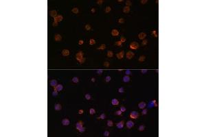 Immunofluorescence analysis of THP-1 cells using CTGF antibody (ABIN6127716, ABIN6139187, ABIN6139190 and ABIN6215053) at dilution of 1:100. (CTGF anticorps  (AA 27-349))