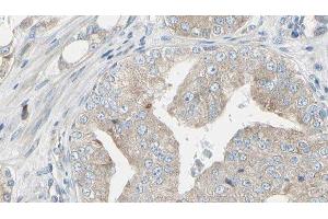 ABIN6279799 at 1/100 staining Human prostate tissue by IHC-P. (RIOK1 anticorps  (C-Term))