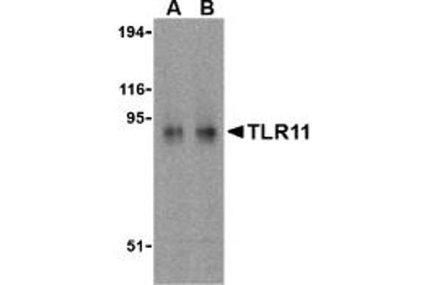 TLR11 anticorps  (C-Term)