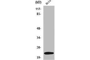 Western Blot analysis of K562 cells using UBE2T Polyclonal Antibody (Ube2t anticorps  (Internal Region))