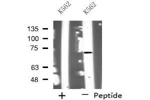 Western blot analysis of extracts from K562 cells, using NOLC1 antibody. (NOLC1 anticorps  (C-Term))