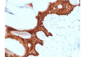 Formalin-fixed, paraffin-embedded human Skin stained with Stratifin Mouse Monoclonal Antibody (CPTC-SFN-2). (14-3-3 sigma/SFN anticorps)