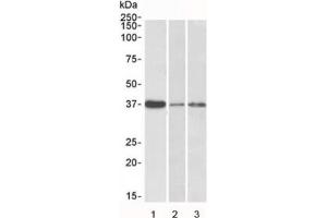 Western blot testing of human 1) liver, 2) skin and 3) tonsil lysate with IL12B antibody at 0. (IL12B anticorps)