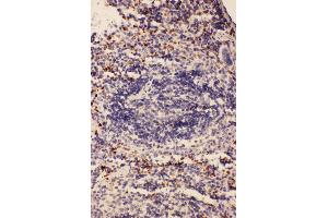 Anti-CD68 antibody,  IHC(P) IHC(P): Mouse Spleen Tissue