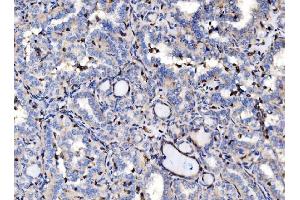 IHC analysis of EVL using anti-EVL antibody (ABIN7600986). (EVL anticorps  (AA 268-400))