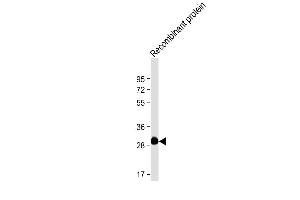 Anti-ROS1 Antibody at 1:4000 dilution + Recombinant protein Lysates/proteins at 20 ng per lane.