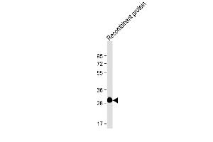 Anti-ROS1 Antibody at 1:4000 dilution + Recombinant protein Lysates/proteins at 20 ng per lane. (ROS1 anticorps)