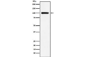 Western blot analysis of Transferrin Receptor 2 expression in HepG2 cell lysate.