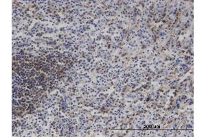 Immunoperoxidase of monoclonal antibody to MAP3K11 on formalin-fixed paraffin-embedded human spleen.