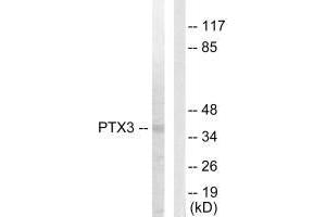 Western blot analysis of extracts from 293 cells, using PTX3 antibody. (PTX3 anticorps  (N-Term))