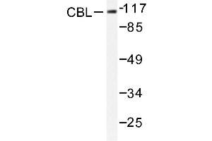 Image no. 1 for anti-Cas-Br-M (Murine) Ecotropic Retroviral Transforming Sequence (CBL) antibody (ABIN272004) (CBL anticorps)