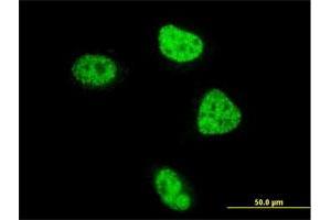 Immunofluorescence of monoclonal antibody to ZBTB33 on HeLa cell. (ZBTB33 anticorps  (AA 564-673))