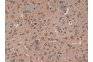 IHC-P analysis of Mouse Brain Tissue, with DAB staining. (MAP1A anticorps  (AA 2552-2759))