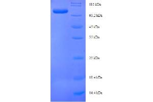 SDS-PAGE (SDS) image for GS Homeobox 1 (GSX1) (AA 1-518), (full length) protein (His-SUMO Tag) (ABIN5711105)