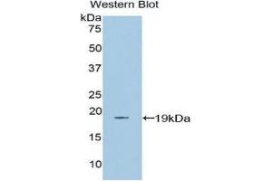 Western Blotting (WB) image for anti-Farnesyl-Diphosphate Farnesyltransferase 1 (FDFT1) (AA 269-417) antibody (ABIN3206188) (FDFT1 anticorps  (AA 269-417))