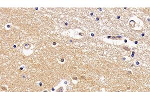Detection of TMPRSS2 in Human Cerebrum Tissue using Polyclonal Antibody to Transmembrane Protease, Serine 2 (TMPRSS2) (TMPRSS2 anticorps  (AA 284-492))