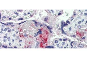 Rabbit Anti-F2 Antibody  arp41757 Paraffin Embedded Tissue: Human Placenta Antibody Concentration: 5 ug/ml