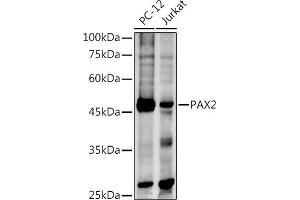 Western blot analysis of extracts of various cell lines, using P antibody (ABIN3017304, ABIN3017305, ABIN1681265 and ABIN6220029) at 1:500 dilution. (PAX2A anticorps)