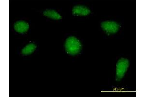 Immunofluorescence of purified MaxPab antibody to HSPC142 on HeLa cell.