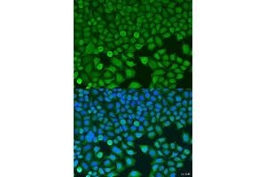 anti-Branched Chain Ketoacid Dehydrogenase Kinase (BCKDK) (AA 153-412) antibody