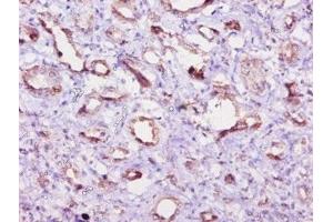 Immunohistochemistry of paraffin-embedded human kidney tissue using ABIN7152198 at dilution of 1:10 (eIF4EBP2 anticorps  (AA 1-120))