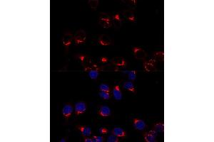 anti-USO1 Homolog, Vesicle Docking Protein (USO1) (AA 663-962) antibody