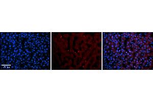 Rabbit Anti-TEAD4 Antibody    Formalin Fixed Paraffin Embedded Tissue: Human Adult liver  Observed Staining: Nuclear in endothelial cells not in hepatocytes Primary Antibody Concentration: 1:600 Secondary Antibody: Donkey anti-Rabbit-Cy2/3 Secondary Antibody Concentration: 1:200 Magnification: 20X Exposure Time: 0. (TEAD4 anticorps  (N-Term))