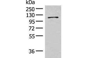 Western blot analysis of Hela cell lysate using FANCB Polyclonal Antibody at dilution of 1:550