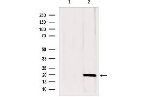 Western blot analysis of extracts from mouse brain, using CPLX1 antibody. (Complexin 1 anticorps  (N-Term))