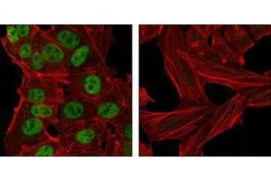 Confocal immunofluorescence analysis of NTERA-2 cells (left) and HeLa cells (right) using Nanog mouse mAb (green).