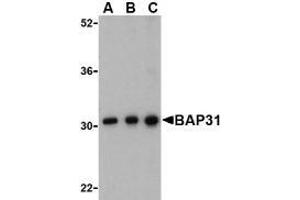 Western blot analysis of BAP31 in Ramos cell lysate with AP30123PU-N BAP31 antibody at (A) 0. (BCAP31 anticorps  (C-Term))