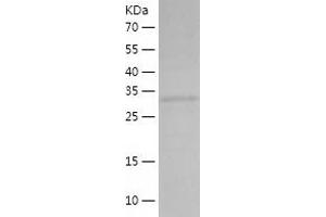 Western Blotting (WB) image for Dihydrodiol Dehydrogenase (DDH) (AA 1-323) protein (His tag) (ABIN7122663)