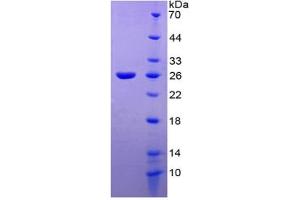 SDS-PAGE of Protein Standard from the Kit  (Highly purified E.