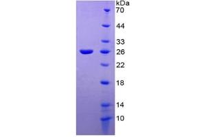 SDS-PAGE of Protein Standard from the Kit  (Highly purified E. (TIE1 Kit ELISA)