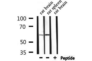 Western blot analysis of extracts from rat brain,rat spleen, using PPP2R5A Antibody.