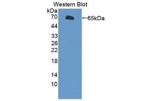 Detection of Recombinant TAT1, Human using Polyclonal Antibody to Testis Anion Transporter 1 (TAT1) (SLC26A8 anticorps  (AA 664-970))