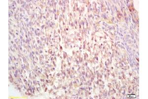 Formalin-fixed and paraffin embedded mouse embryo labeled with Rabbit Anti-ADORA2B Polyclonal Antibody, Unconjugated (ABIN1713360) at 1:200 followed by conjugation to the secondary antibody and DAB staining