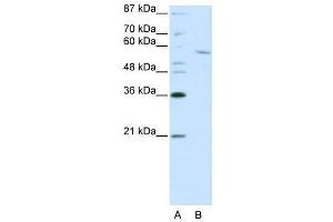 WB Suggested Anti-RCOR1  Antibody Titration: 0. (CoREST anticorps  (C-Term))