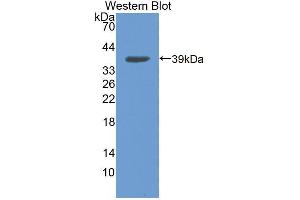 Western blot analysis of the recombinant protein. (NCOA3 anticorps  (AA 1-269))
