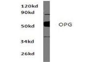 Image no. 1 for anti-Tumor Necrosis Factor Receptor Superfamily, Member 11b (TNFRSF11B) antibody (ABIN272130)