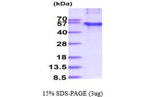 SDS-PAGE (SDS) image for Hydroxyacylglutathione Hydrolase (HAGH) (AA 1-260) (Active) protein (His tag) (ABIN667841)