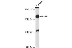 Western blot analysis of extracts of Rat brain, using EGFR antibody (ABIN6133681, ABIN6139977, ABIN6139982 and ABIN6219256) at 1:1000 dilution. (EGFR anticorps  (AA 1100-1200))