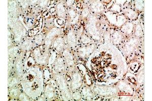 Immunohistochemical analysis of paraffin-embedded human-kidney, antibody was diluted at 1:200 (Endoglin anticorps  (AA 370-430))