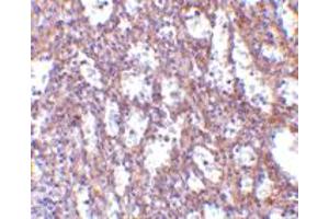 Immunohistochemistry of IL32 in human spleen tissue with IL32 polyclonal antibody  at 10 ug/mL . (IL32 anticorps  (C-Term))