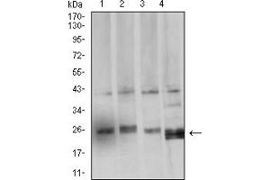 Western blot analysis using BCL2L2 mouse mAb against HCT116 (1), LOVO (2), SW480 (3), and HL-60 (4) cell lysate.