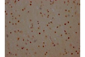 IHC image of ABIN7127667 diluted at 1:100 and staining in paraffin-embedded human brain tissue performed on a Leica BondTM system.