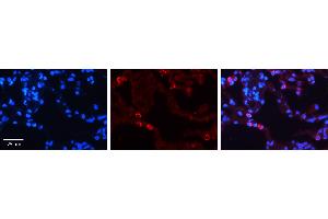 P4HB antibody - C-terminal region          Formalin Fixed Paraffin Embedded Tissue:  Human Lung Tissue    Observed Staining:  Cytoplasm of pneumocytes   Primary Antibody Concentration:  1:600    Secondary Antibody:  Donkey anti-Rabbit-Cy3    Secondary Antibody Concentration:  1:200    Magnification:  20X    Exposure Time:  0. (P4HB anticorps  (C-Term))