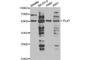 Western blot analysis of extracts of various cell lines, using PLAT antibody (ABIN5973300) at 1/1000 dilution. (PLAT anticorps)