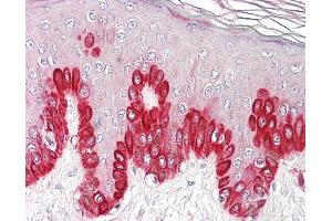 Anti-SIRT1 antibody IHC of human skin. (SIRT1 anticorps  (AA 577-590))